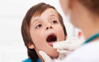 Часто болит горло у ребенка: что делать?