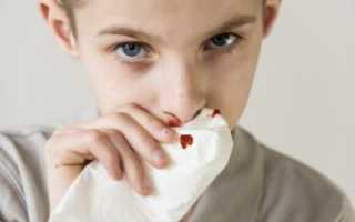 Почему идет кровь с носа: физиологические и патологические причины