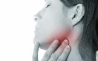 Воспаленные лимфоузлы под челюстью: эффективное лечение