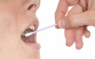 Как распознать и вылечить стафилококк во рту?