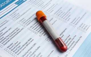 Анализ на пищевую непереносимость: сколько стоит тест и где можно сдать кровь