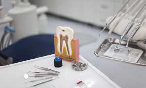 Почему зубы стали чувствительными и болят? Все о гиперестезии