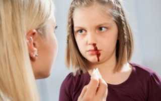 Как правильно и быстро остановить кровь из носа у ребенка?