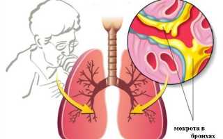 Лечение сухого и влажного кашля при бронхиальной астме у детей и взрослых