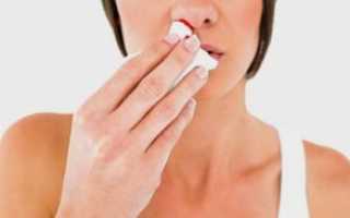 Как остановить кровотечение из носа и что делать запрещено?