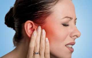 Перихондрит ушной раковины, лечение заболевания, профилактика и прогноз