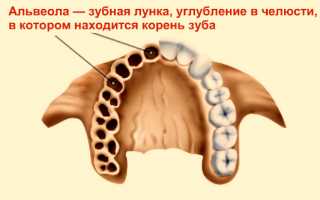 Альвеолит после удаления зуба: лечение, фото, симптомы и признаки, МКБ-10