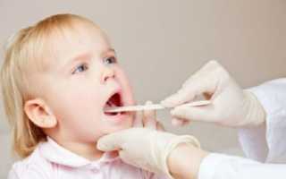 Лечение ангины у детей 3 лет: типы ангин и особенности их лечения