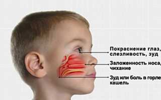 Поллиноз: симптомы и лечение сезонной аллергии в период обострения у детей и взрослых