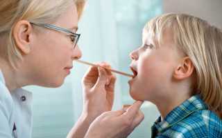 Как вылечить горло у ребёнка, общие принципы лечения