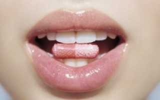 Стафилококк в горле: как проявляется и как лечить?