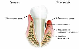 Дентамет (гель стоматологический): инструкция по применению, цена, отзывы, состав, аналоги